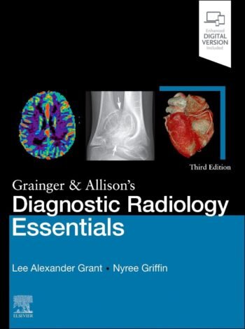 Grant Grainger & Allison's Diagnostic Radiology Essentials: 3e by Lee A. Grant (Author), Nyree Griffin (Author)