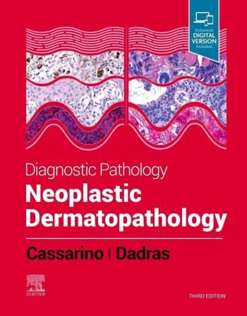 Diagnostic Pathology: Neoplastic Dermatopathology, 3e By Cassarino
