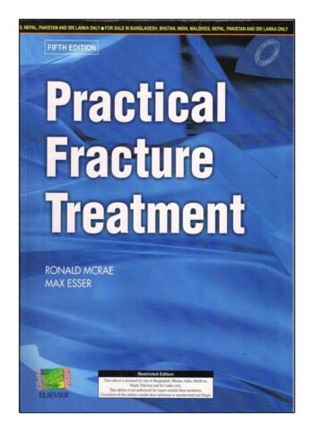 Practical Fracture Treatment, International Edition, 5e by McRae