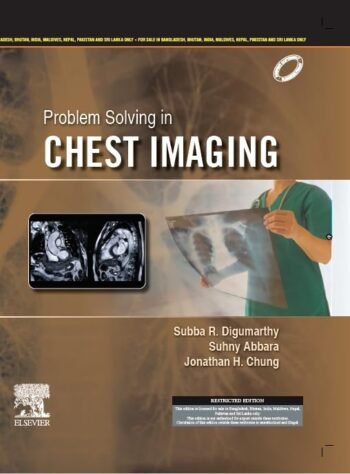 Problem Solving in Chest Imaging (SAE) -1E by Subba Digumarthy