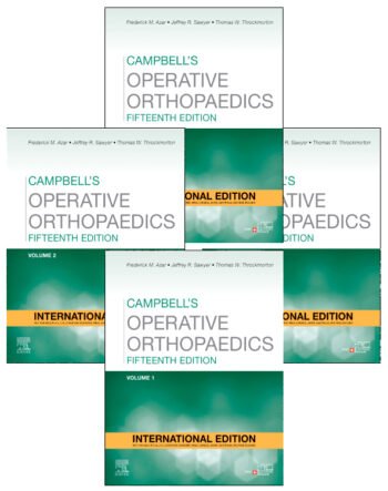 Campbell's Operative Orthopaedics, 4-Volume Set, 15th Edition 9780443117633 english book depot jhansi www.myebd.in Lowest price online my ebd.in Best Medical books website